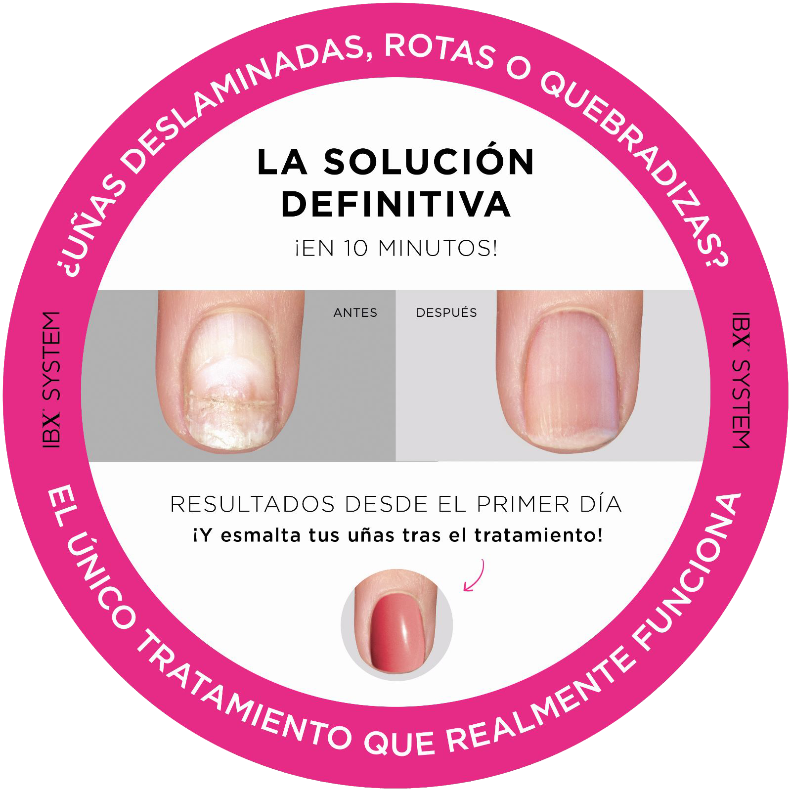 Tratamiento para uñas